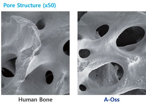  Xenograft – Bioresorbierbares Wundermaterial der Zukunft für den Knochenaufbau?